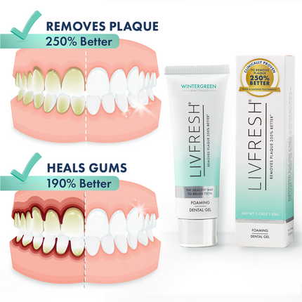 LIVFRESH Dental Gel - Advanced Solution for Superior Teeth Cleaning and Gum Protection