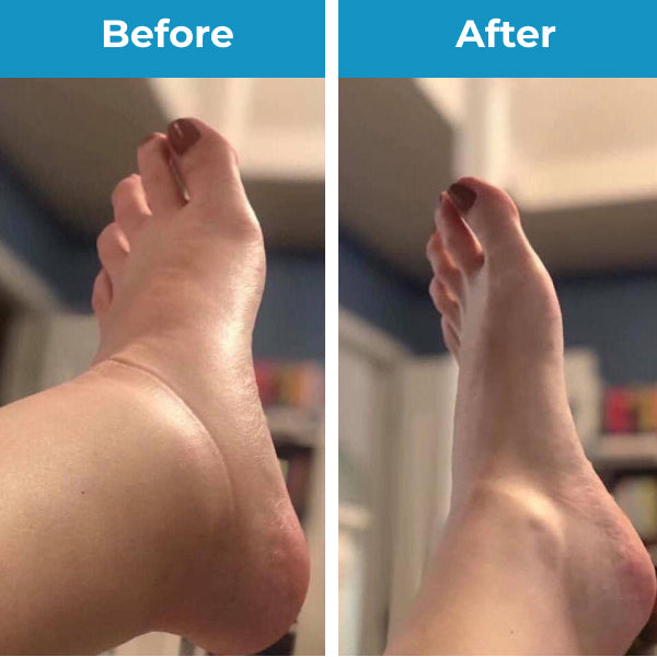 MindInsole Compression Socks