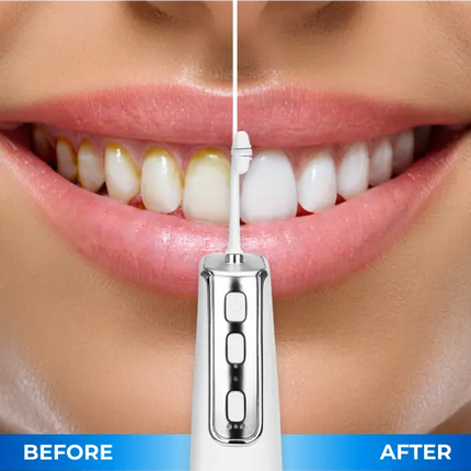 Miracle Smile Magic Flosser Achieves a Dentist-Level Clean at Home