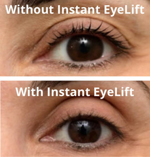 Instantly Lift Your Eyelids for a Youthful Look